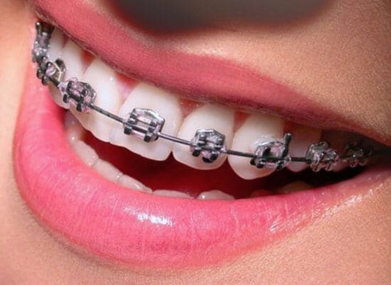 brackets san fernando de henares