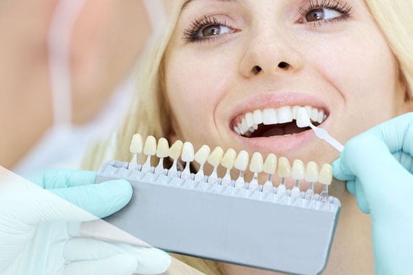 estetica dental carillas